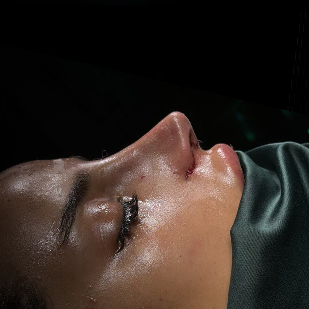 Before and After Result